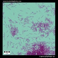 capnocytophaga under microscope